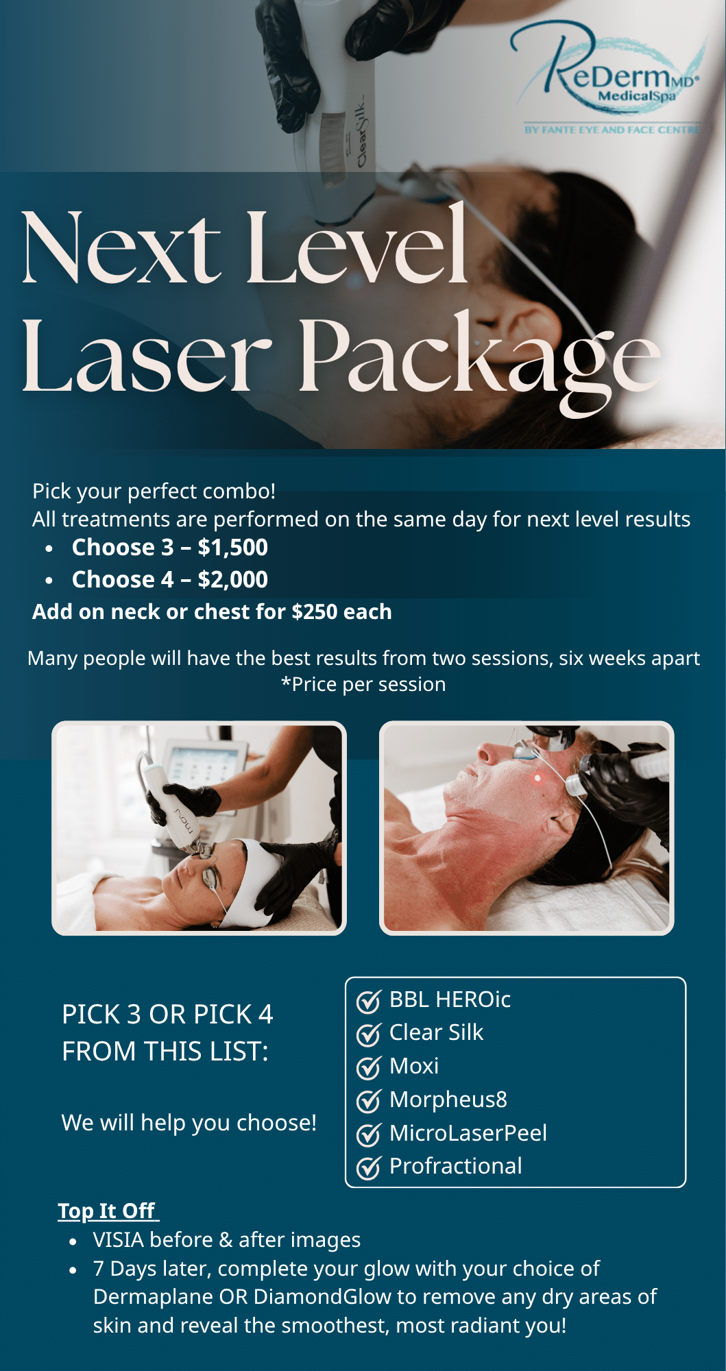 Copy of Rederm NLLP Laser Rack Card (4.5 x 8.5)